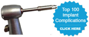 top 100 implant comlications