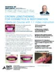 CROWN LENGTHENING FOR COSMETICS AND RESTORATION. HANDS-ON COURSE WITH 1:1 LIVE ONLINE VIDEO INSTRUCTION